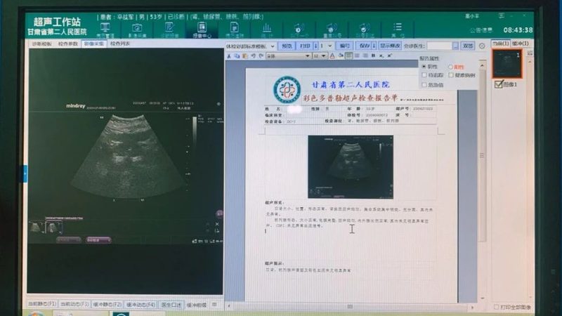 入职体检里为什么会有胸透和钡餐